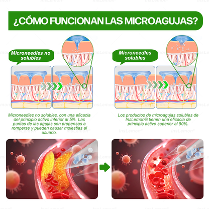 𝐈𝐧𝐬𝐋𝐞𝐦𝐨𝐧® 𝗠𝗼𝗿𝗶𝗻𝗴𝗮 × 𝗕𝗲𝗿𝗯𝗲𝗿𝗶𝗻𝗮 × 𝗔𝗠𝗣𝗞 𝟭𝟬-𝗶𝗻-𝟭 𝗣𝗮𝗿𝗰𝗵𝗲 𝗠𝗲𝘁𝗮𝗯𝗼𝗹𝗶𝗰𝗼 𝗱𝗲 𝗡𝗮𝗻𝗼 𝗠𝗶𝗰𝗿𝗼𝗮𝗴𝗵𝗮 (🇪🇸 Solo una vez al día, cambios visibles en 7 días) ✅ Para sobrepeso, diabetes, apnea del sueño, problemas articulares y más.